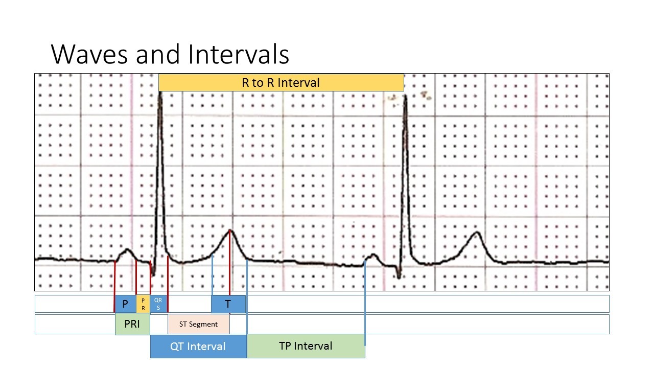 Waves and Intervals Illustration ECG Guru Instructor Resources